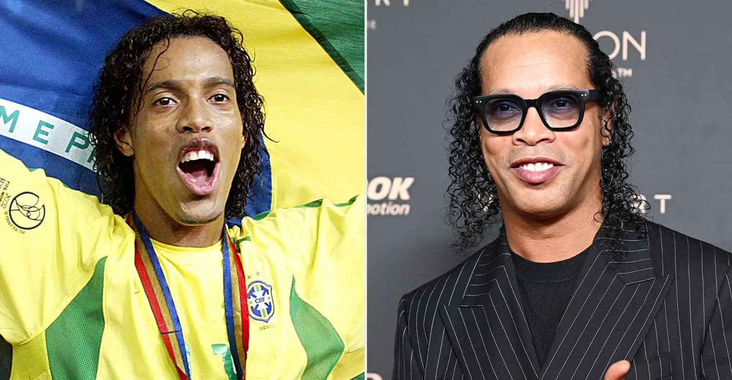Ronaldinho teeth